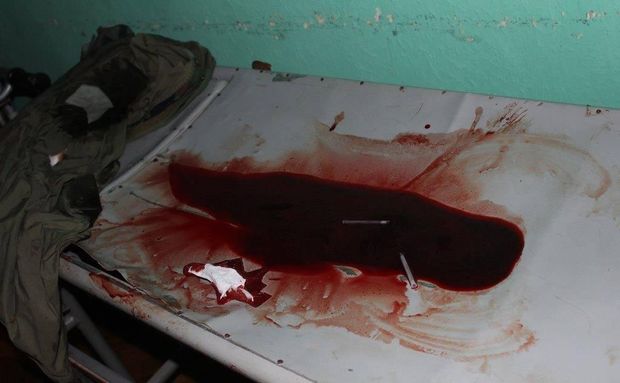 Кровавая перестрелка на Житомирщине: есть раненые (18+) 7
